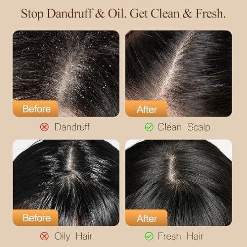 Sulfate-Free Hair Care Set - Dandruff & Oil Control