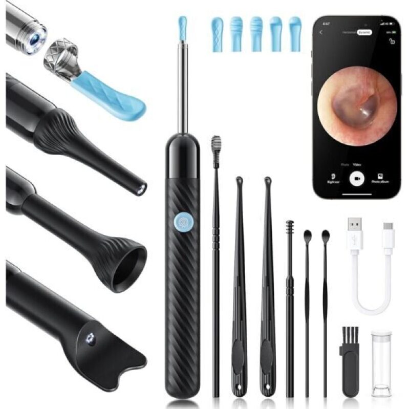 Loyker X6 Ear Wax Removal Tool Camera - 1080P Ear Cleaner with Camera