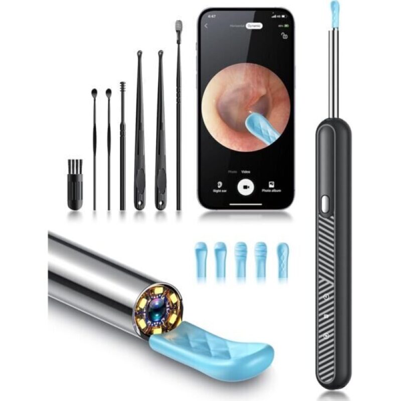 High-Resolution Ear Wax Removal Tool with Camera - 50% Off