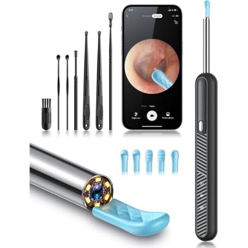 High-Resolution Ear Wax Removal Tool with Camera - 50% Off
